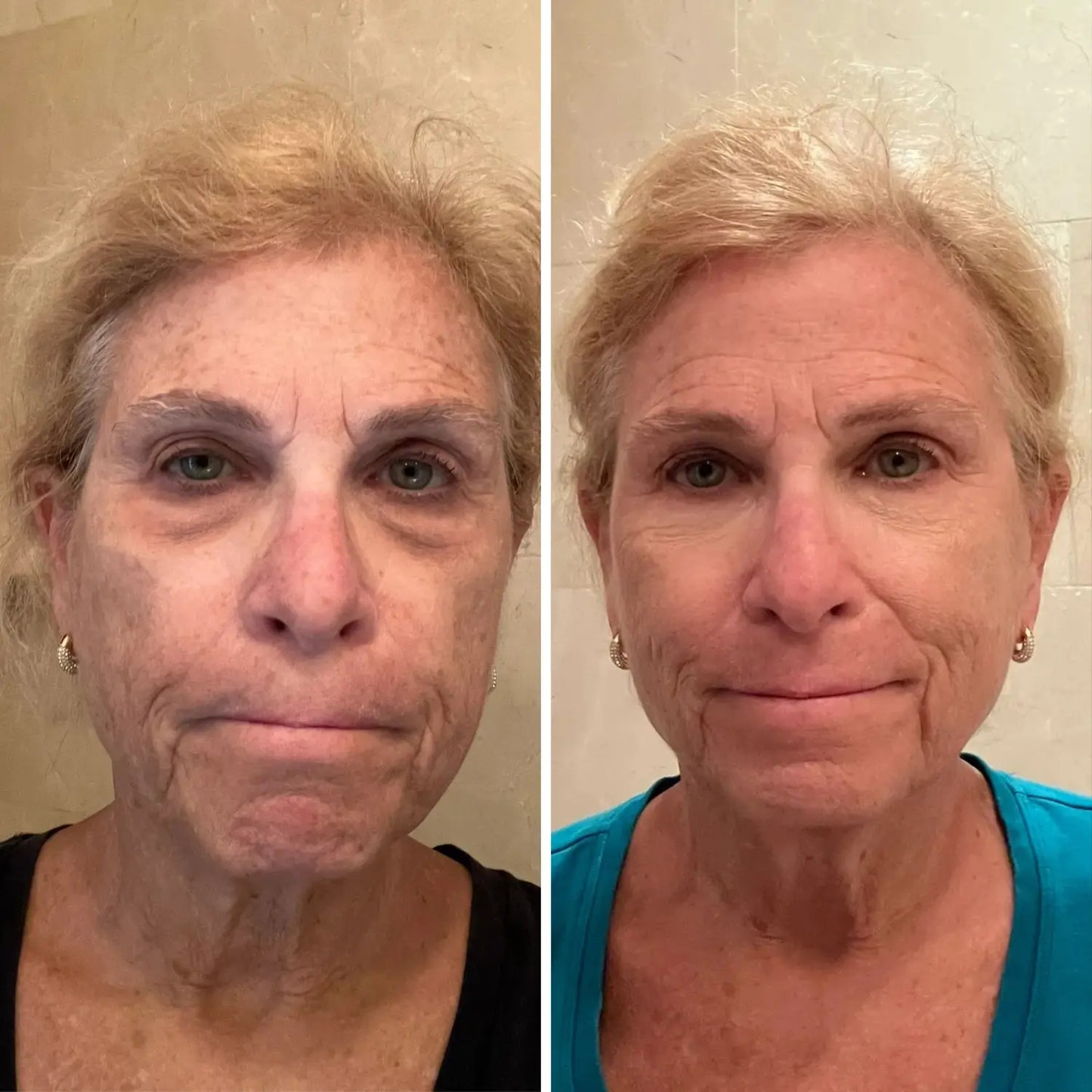 LIRAVÉA Balm – All-in-One Augenpflege für ein frischeres & glatteres Hautbild