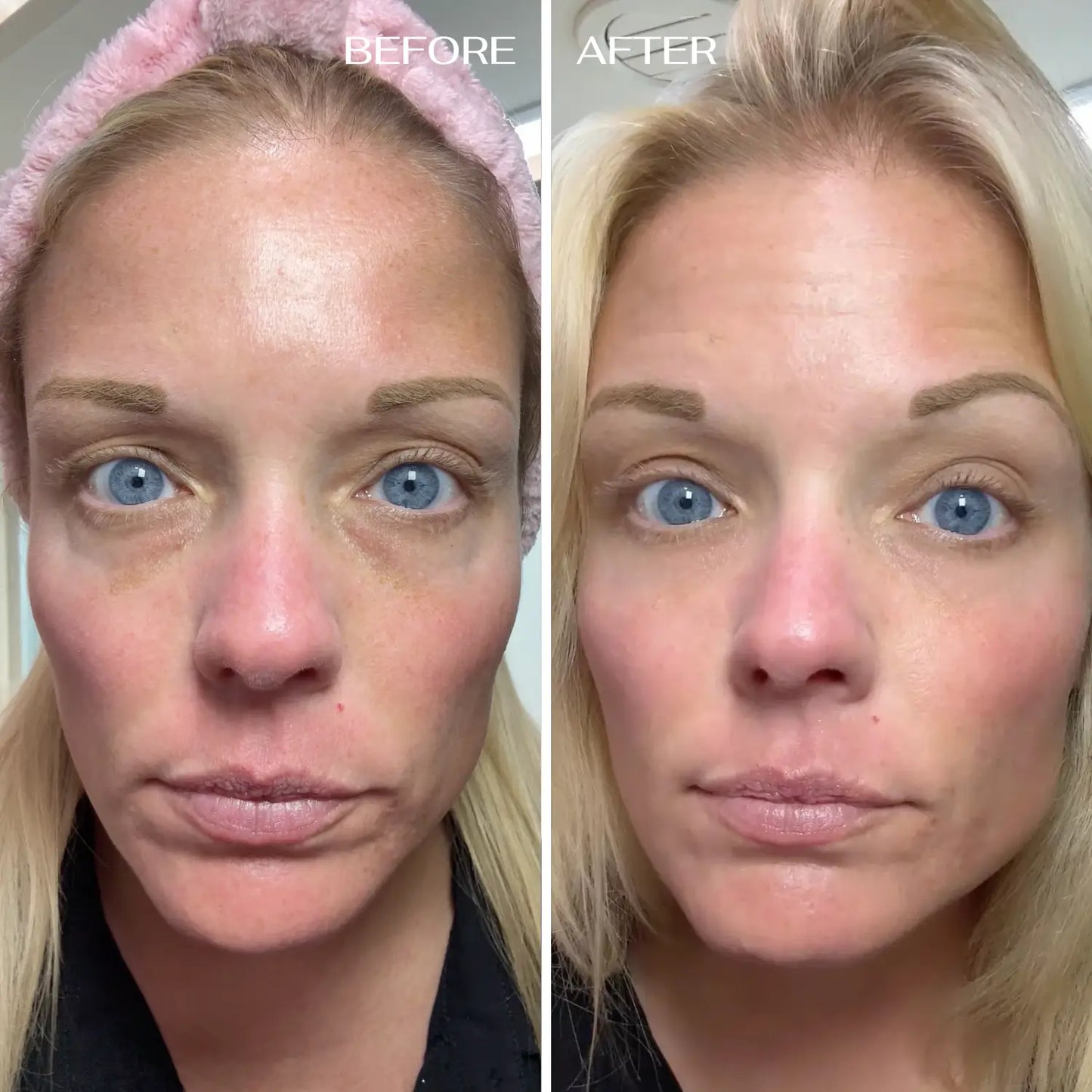 LIRAVÉA Balm – All-in-One Augenpflege für ein frischeres & glatteres Hautbild