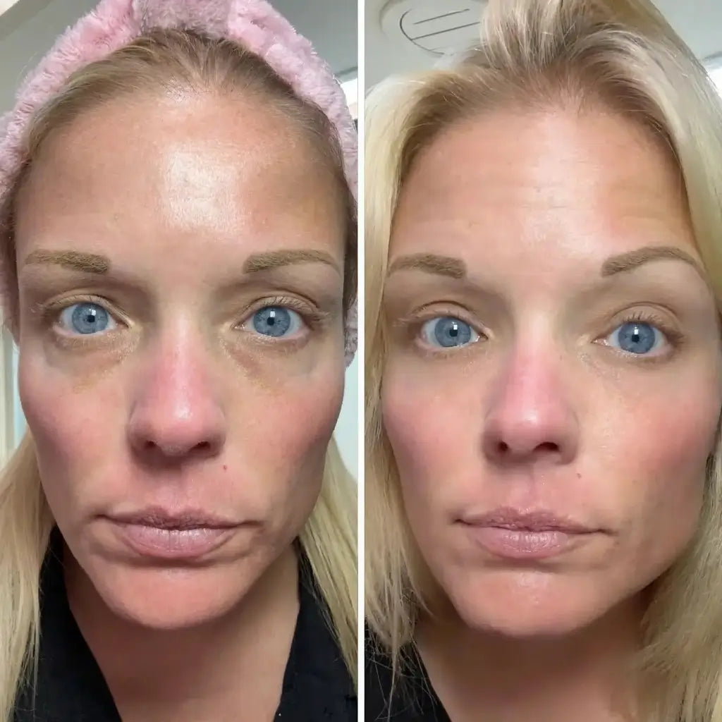 LIRAVÉA Balm – All-in-One Augenpflege für ein frischeres & glatteres Hautbild