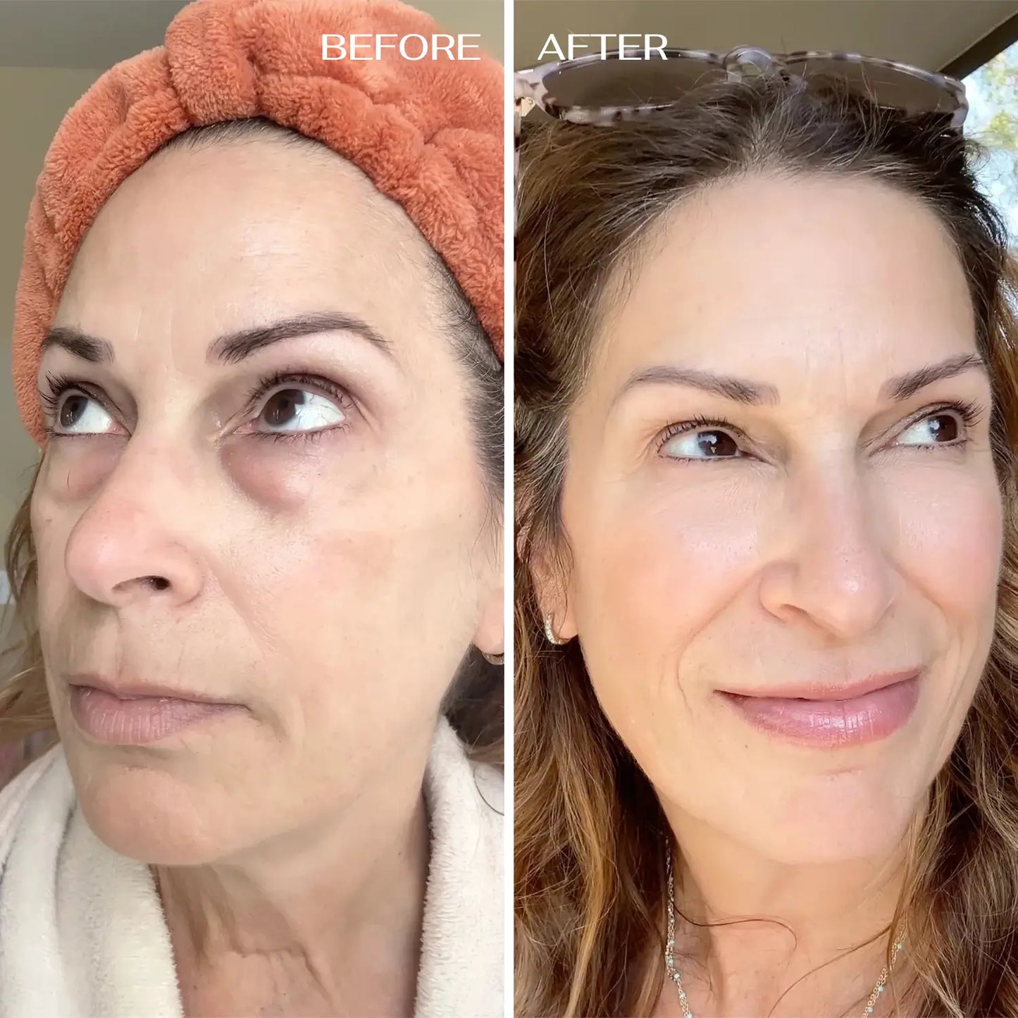 LIRAVÉA Balm – All-in-One Augenpflege für ein frischeres & glatteres Hautbild