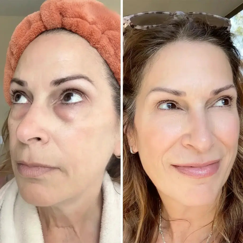 LIRAVÉA Balm – All-in-One Augenpflege für ein frischeres & glatteres Hautbild