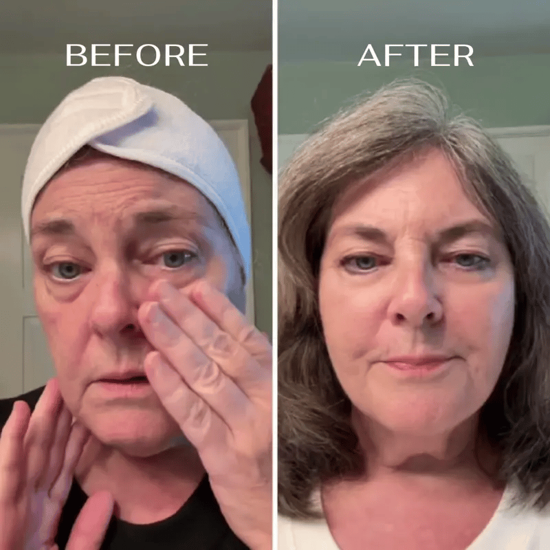 Echte Ergebnisse, die deine Augen lieben werden